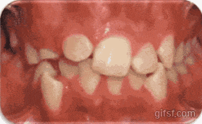 4v5M6zalLIWwweiu8eWs8G.gif