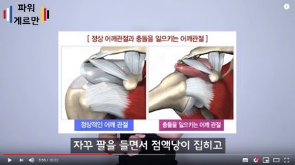 어깨운동으로 사이드 레터럴 레이즈를 트레이너가 권하면 트레이너를 거르라네요. - 뽐뿌:건강/헬스