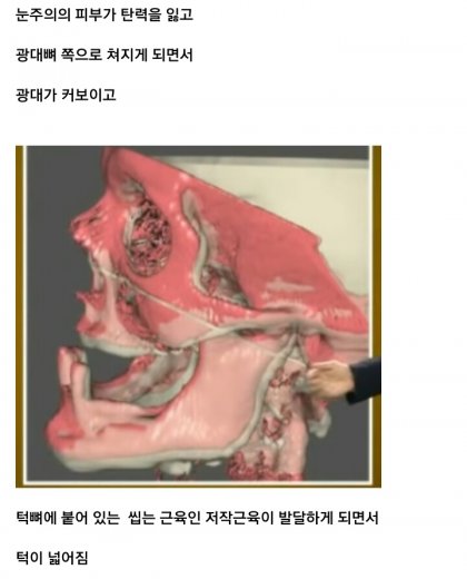 나이들면 얼굴 커지는 이유...Jpg - 뽐뿌:자유게시판