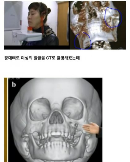 나이들면 얼굴 커지는 이유...Jpg - 뽐뿌:자유게시판